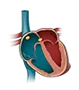  Cardiologist in Raipur 