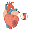 Best Heart Failure Treatment in Raipur
