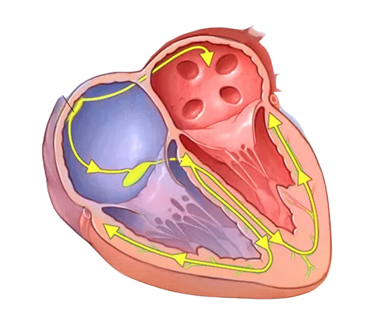 Pacemaker Treatment in Raipur
