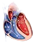 Valvular Heart Disease